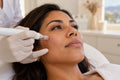 Vitaminas con dermapen
