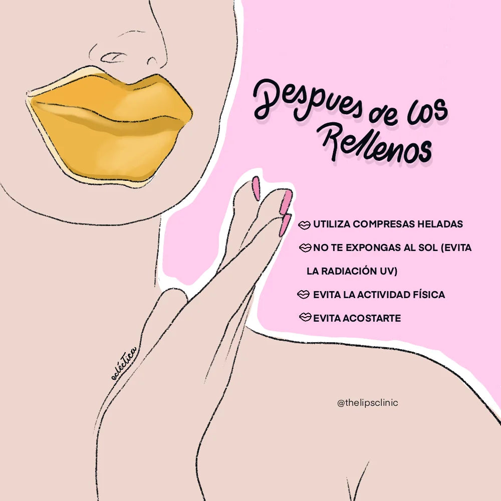Ilustración con los cuidados después de los rellenos